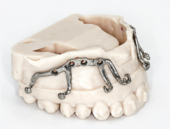 MARPE appliance view 1
