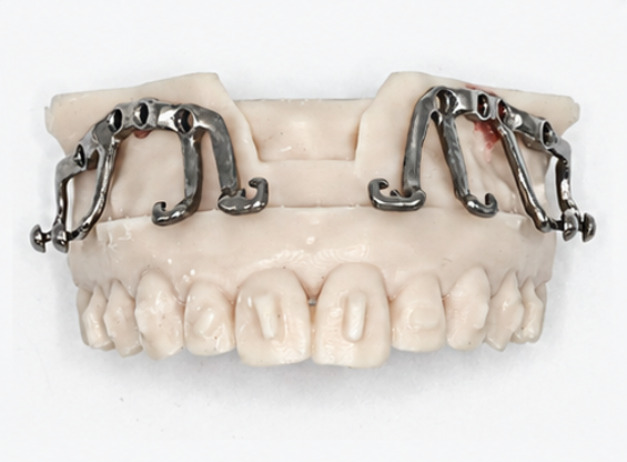 MARPE appliance view 2