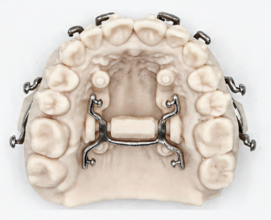 MARPE appliance view 3